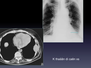 K thaäân di caên xs
 