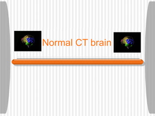 Normal CT brain 