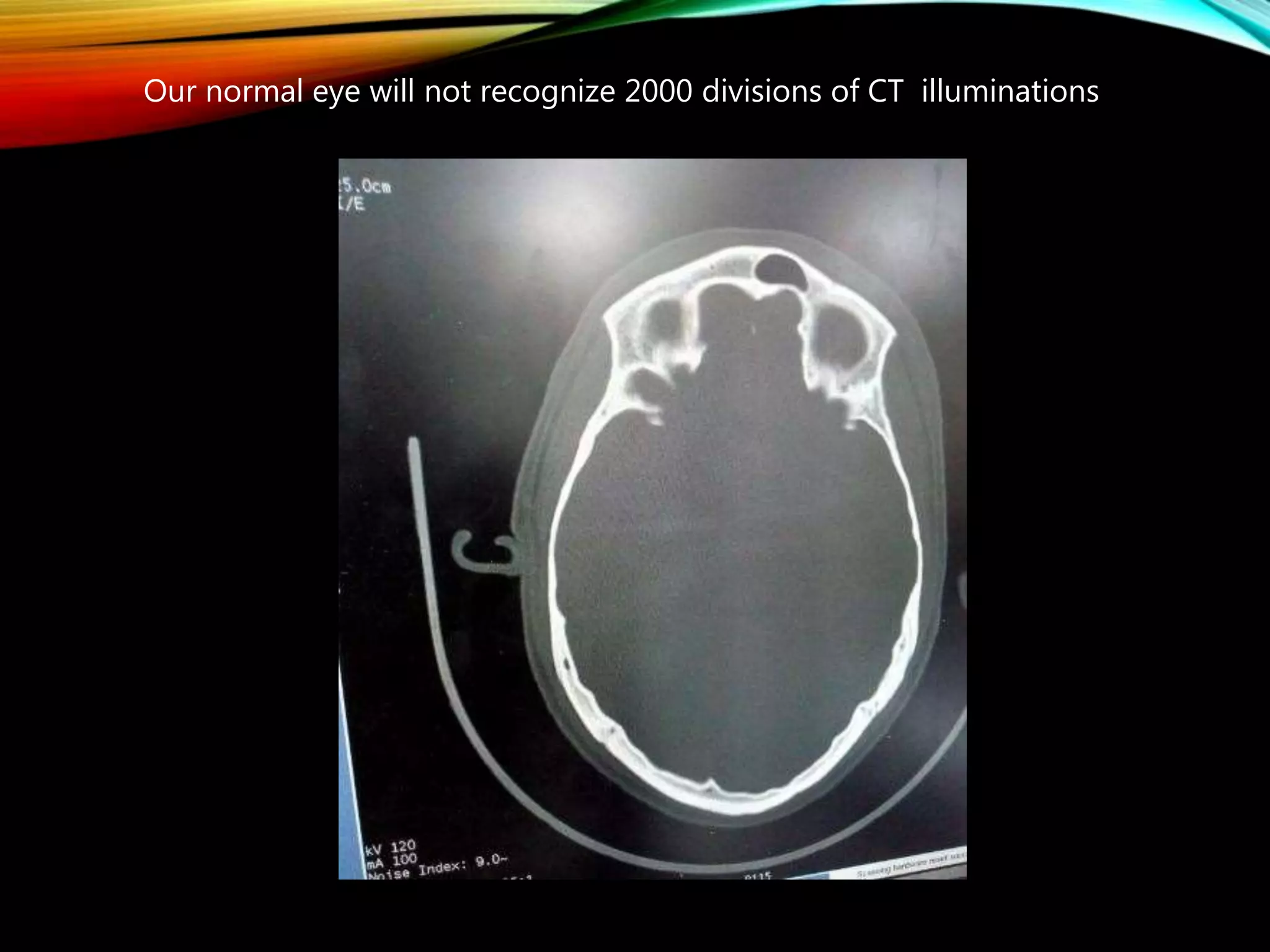 Ct numbers window width and window level pptx lung and respiratory