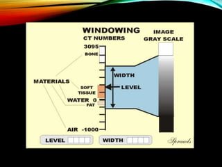 CT numbers, window width and window level