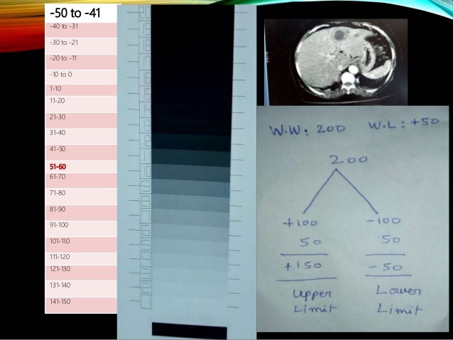 CT numbers, window width and window level