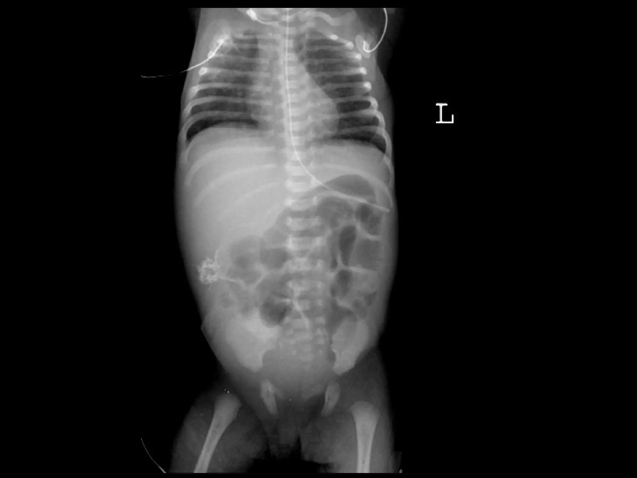 The Radiology of common paediatric surgery conditions | PPT
