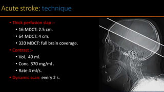 • Thick perfusion slap :-
• 16 MDCT: 2.5 cm.
• 64 MDCT: 4 cm.
• 320 MDCT: full brain coverage.
• Contrast :-
• Vol. 40 ml.
• Conc. 370 mg/ml .
• Rate 4 ml/s.
• Dynamic scan: every 2 s.
 