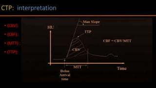 • (CBV):
• (CBF):
• (MTT) :
• (TTP):
 