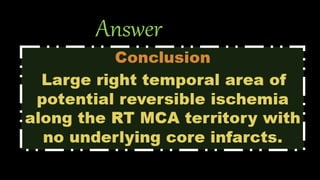 Answer
• CBV: Normal.
• MTT: Prolonged at right temporal lobe along the territory of RT MCA.
• CBF: Decreased at right temporal lobe along the territory of RT MCA.
• TTP: Prolonged at right temporal lobe along the territory of RT MCA.
• Match/ mismatch: mismatched CBV/MTT
• Core/Penumbra: penumbra with no core.
 