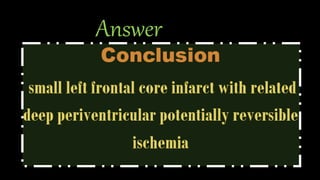 Answer
• CBV: decreased at left frontal cortex.
• MTT: Prolonged at left cortical & deep periventricular region.
• CBF: Decreased at left cortical & deep periventricular region.
• TTP: Prolonged at left cortical & deep periventricular region.
• Match/ mismatch: mismatched CBV/MTT
• Core/Penumbra: penumbra with cortical core.
 