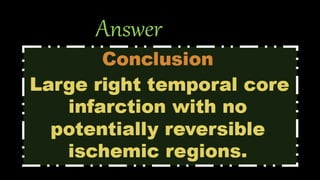 Answer
• CBV: decreased at RT MCA territory .
• MTT: Prolonged at RT MCA territory.
• CBF: Decreased at RT MCA territory .
• TTP: Prolonged at RT MCA territory .
•Match/ mismatch: matched CBV/MTT
•Core/Penumbra: core with no penumbra .
 