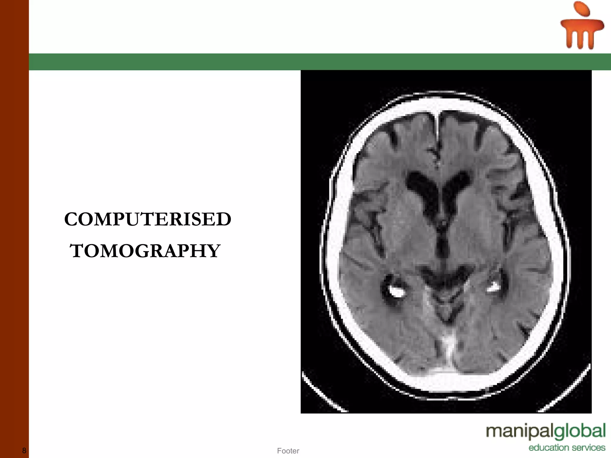 BASICS IN NEUROIMAGING: CT, MRI AND PET | PPT