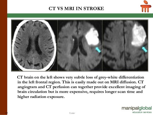 ct scan vs mri