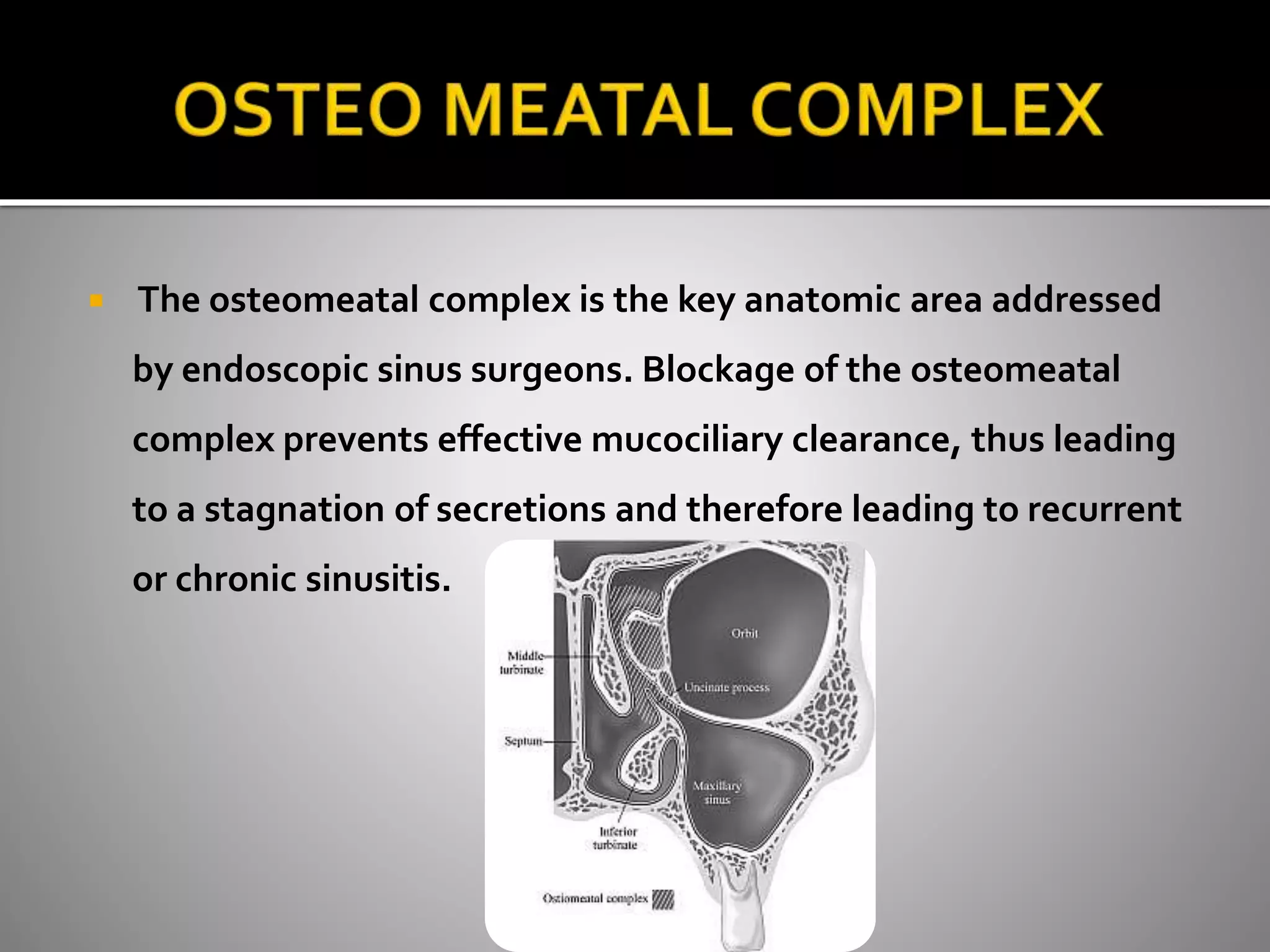  The osteomeatal complex is the key anatomic area addressed 
by endoscopic sinus surgeons. Blockage of the osteomeatal 
complex prevents effective mucociliary clearance, thus leading 
to a stagnation of secretions and therefore leading to recurrent 
or chronic sinusitis. 
 
