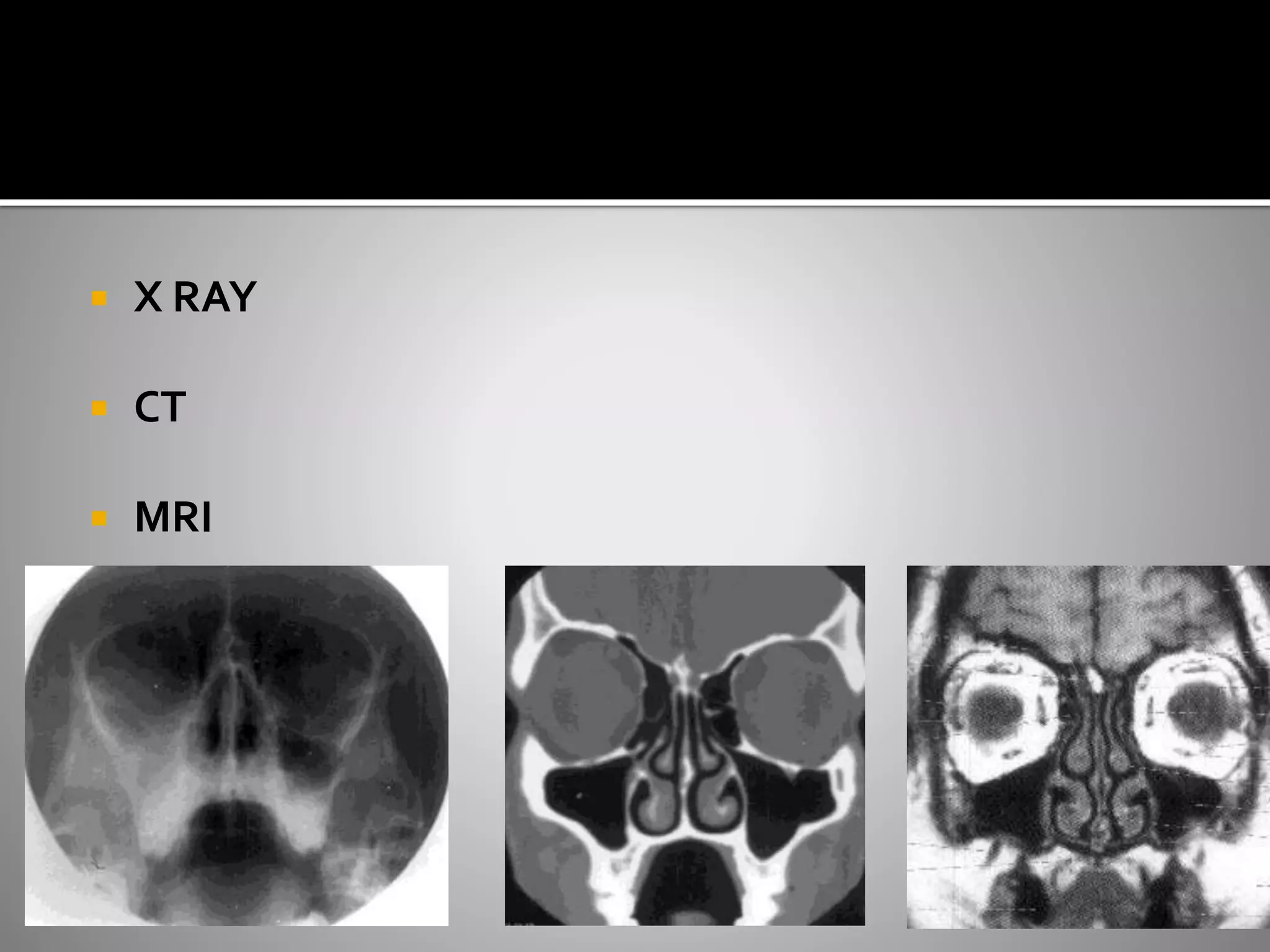  X RAY 
 CT 
 MRI 
 