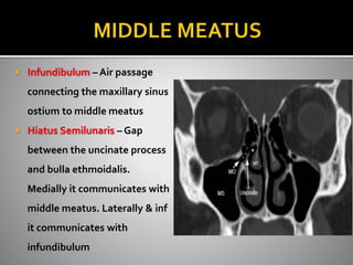 Each sinuses have 
orifices that open into 
the meatus, covered by 
turbinates 
 