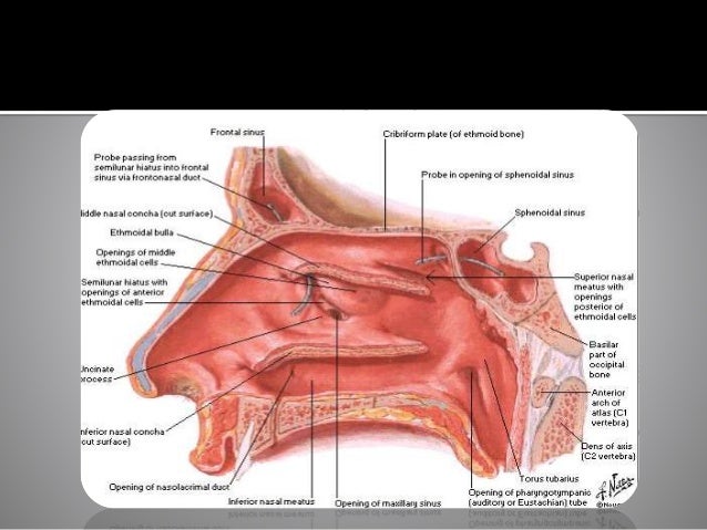Brain structure and sinusitis