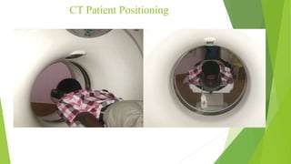 Ct pns - Anatomical varients | PPTX