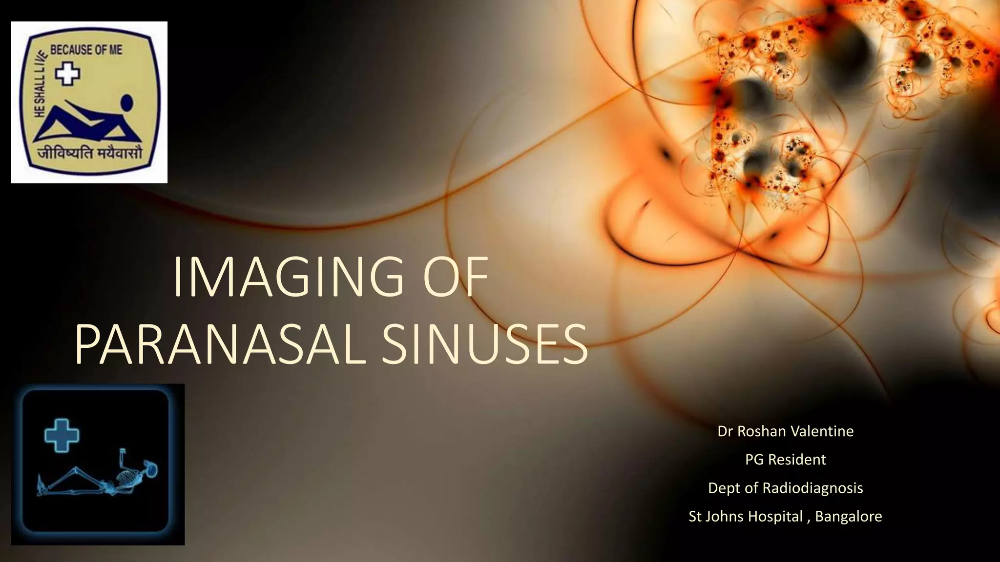 IMAGING OF
PARANASAL SINUSES
Dr Roshan Valentine
PG Resident
Dept of Radiodiagnosis
St Johns Hospital , Bangalore
 