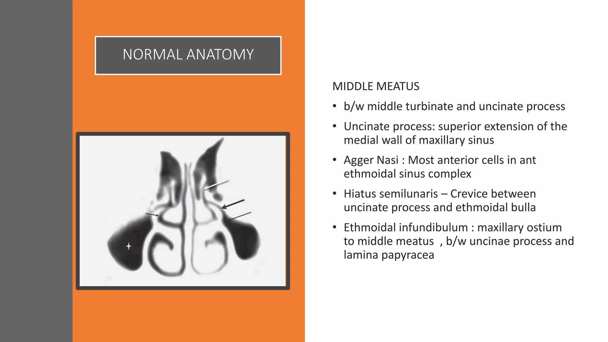 NORMAL ANATOMY
MIDDLE MEATUS
• b/w middle turbinate and uncinate process
• Uncinate process: superior extension of the
medial wall of maxillary sinus
• Agger Nasi : Most anterior cells in ant
ethmoidal sinus complex
• Hiatus semilunaris – Crevice between
uncinate process and ethmoidal bulla
• Ethmoidal infundibulum : maxillary ostium
to middle meatus , b/w uncinae process and
lamina papyracea
 