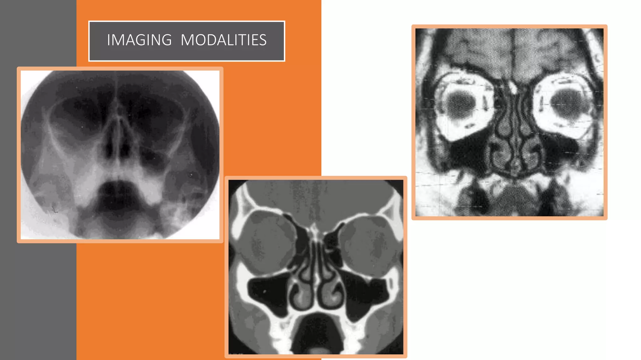 IMAGING MODALITIES
 