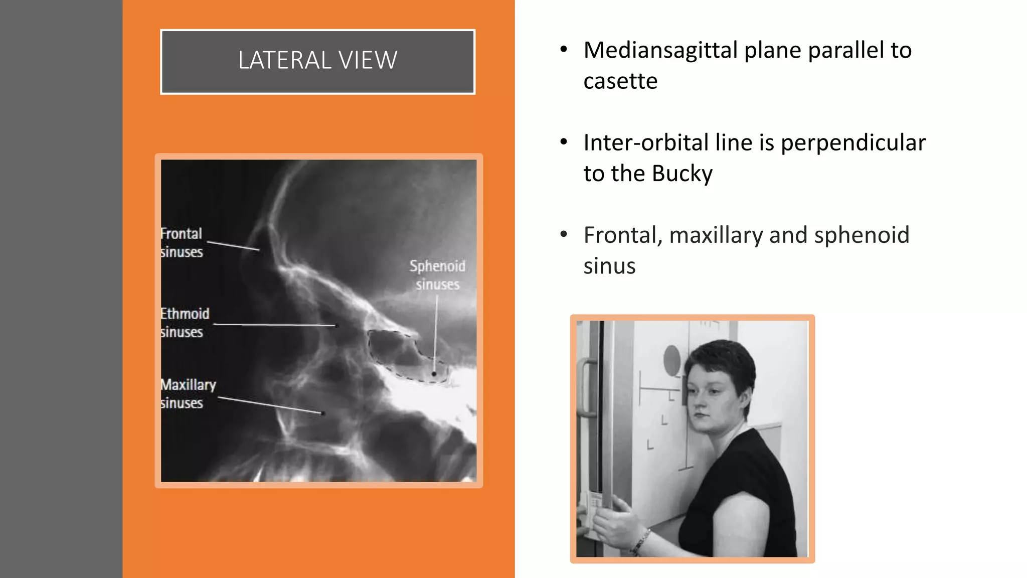LATERAL VIEW • Mediansagittal plane parallel to
casette
• Inter-orbital line is perpendicular
to the Bucky
• Frontal, maxillary and sphenoid
sinus
 