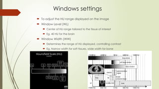 Windows settings
 To adjust the HU range displayed on the image
 Window Level (WL)
 Center of HU range tailored to the tissue of interest
 Eg. 40 HU for the brain
 Window Width (WW)
 Determines the range of HU displayed, controlling contrast
 Eg. Narrow width for soft tissues, wide width for bone
 