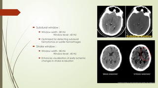  Subdural window :
 Window width : 80 HU
Window level : 40 HU
 Optimized for detecting subdural
hematomas or subtle hemorrhages
 Stroke window :
 Window width : 80 HU
Window level : 40 HU
 Enhances visualization of early ischemic
changes in stroke evaluation
 