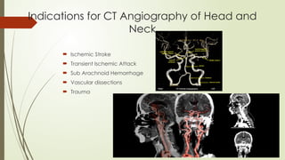 Indications for CT Angiography of Head and
Neck
 Ischemic Stroke
 Transient Ischemic Attack
 Sub Arachnoid Hemorrhage
 Vascular dissections
 Trauma
 