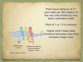 Ct Distance Ct ppt 2 | PPTX