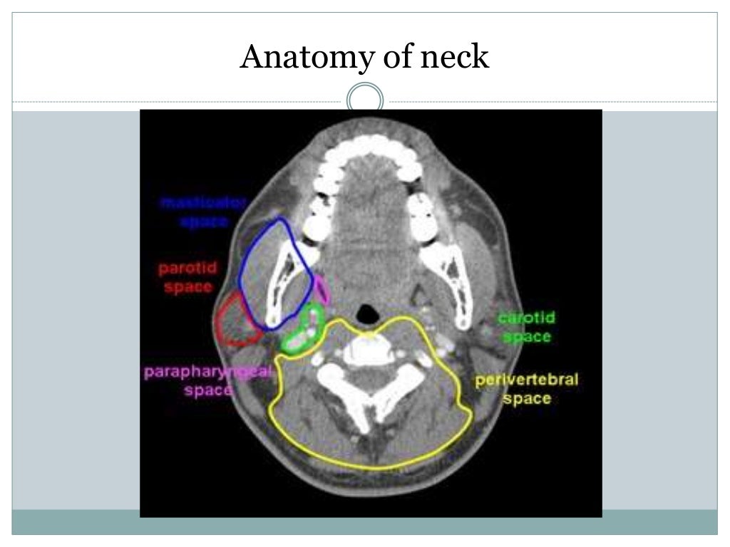 CT procedure of neck