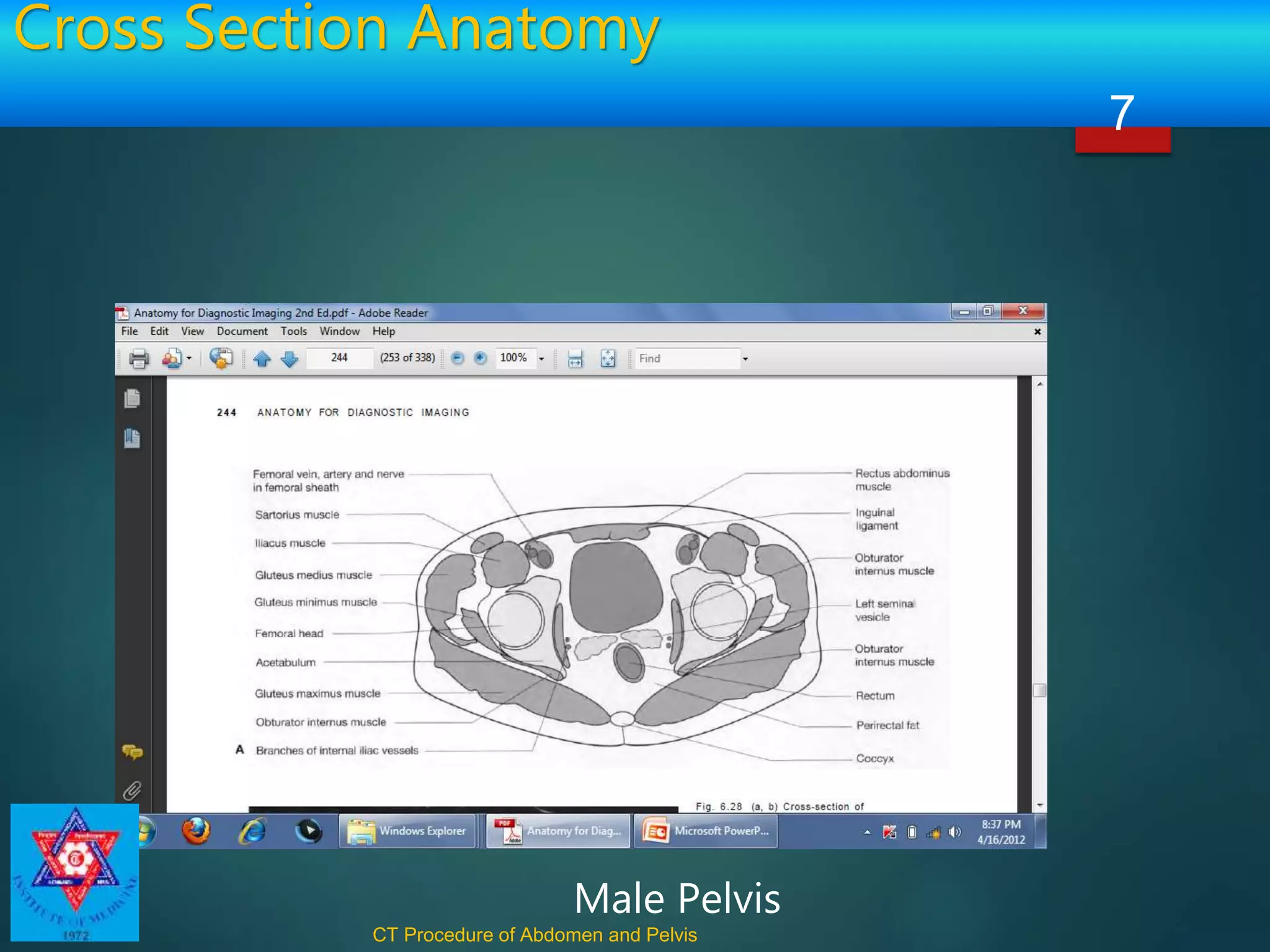 Cross Section Anatomy
CT Procedure of Abdomen and Pelvis
7
Male Pelvis
 