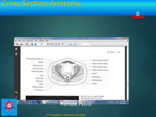 CT Procedure OF Abdomen & Pelvis | PPTX