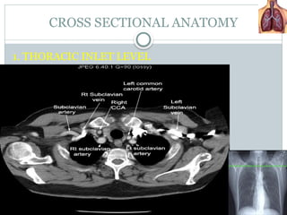 Comprehensive Guide to CT Chest Procedures and Thoracic Anatomy | PPTX