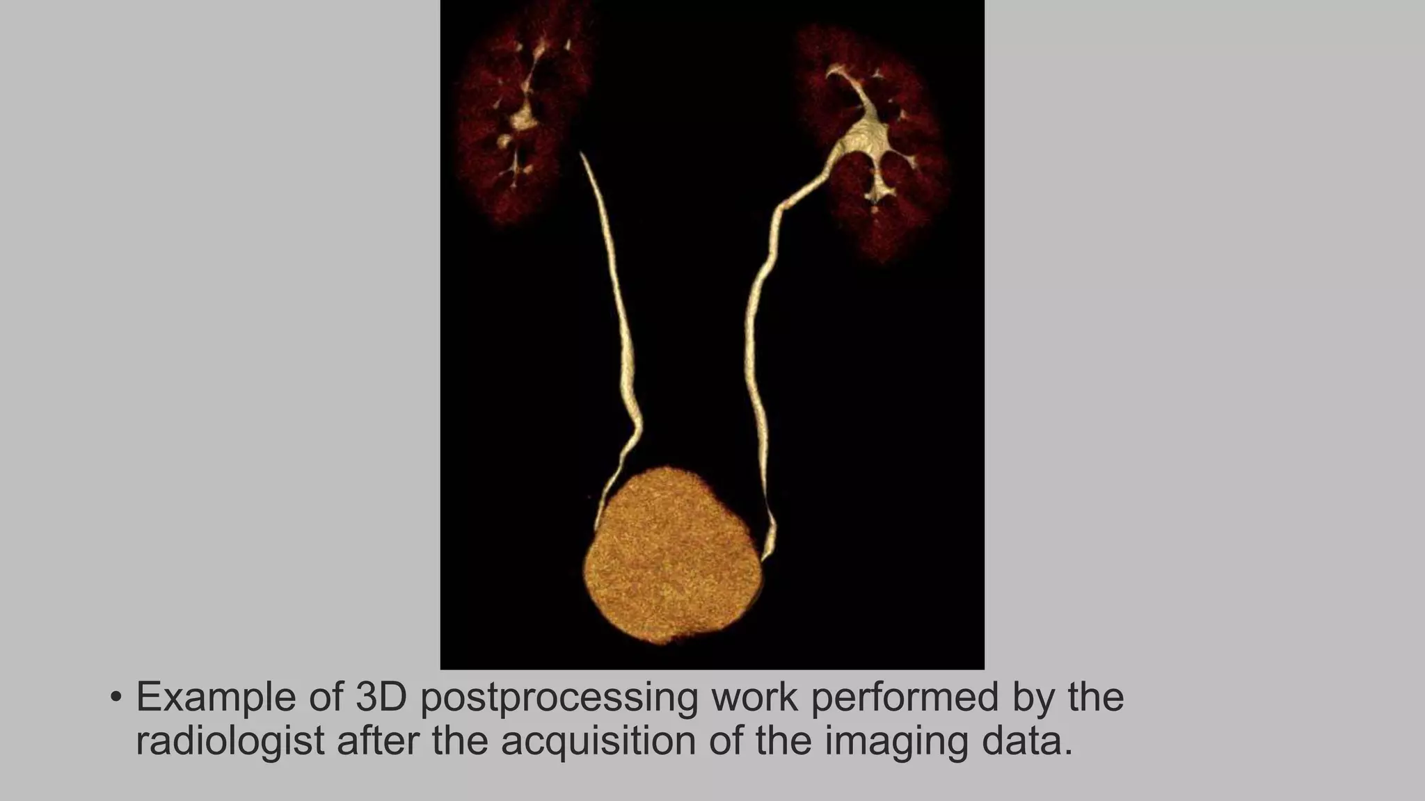 • Example of 3D postprocessing work performed by the
radiologist after the acquisition of the imaging data.
 