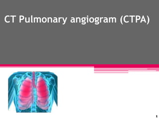CT Pulmonary angiogram (CTPA)

1

 