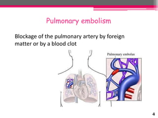 Pulmonary embolism
Blockage of the pulmonary artery by foreign
matter or by a blood clot

4

 