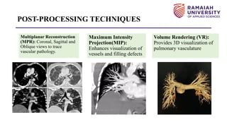 Mpr Volume Rendering CT Pulmonary Angiography Protocol presentation | PPTX
