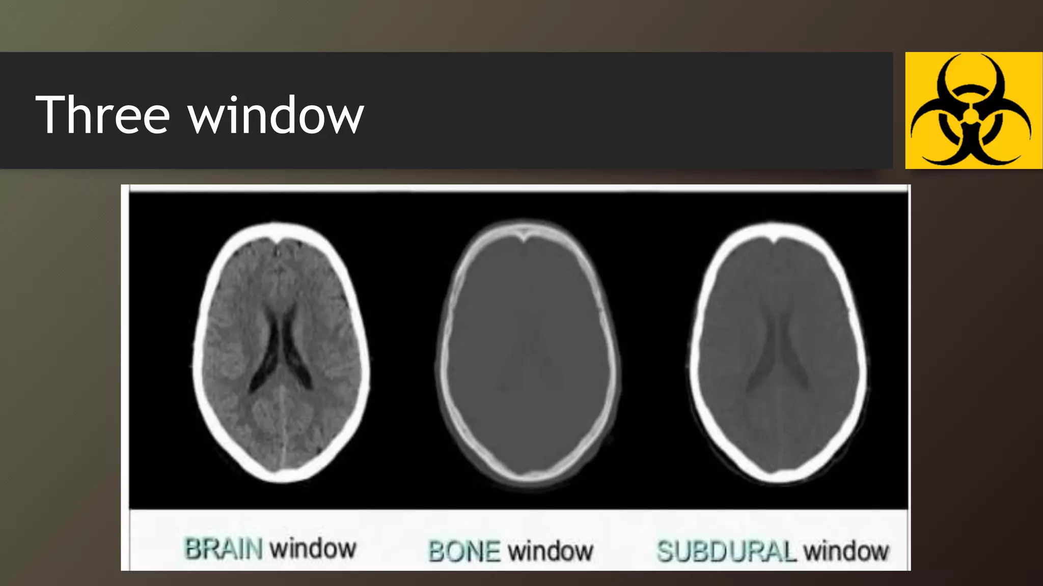 brian CT introdaction pediatric radiology | PPTX