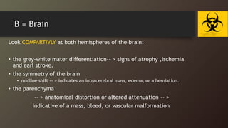 B = Brain
Look COMPARTIVLY at both hemispheres of the brain:
• the grey-white mater differentiation-- > signs of atrophy ,ischemia
and earl stroke.
• the symmetry of the brain
• midline shift -- > indicates an intracerebral mass, edema, or a herniation.
• the parenchyma
-- > anatomical distortion or altered attenuation -- >
indicative of a mass, bleed, or vascular malformation
 