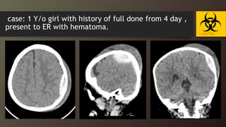 case: 1 Y/o girl with history of full done from 4 day ,
present to ER with hematoma.
 