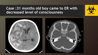 Case :31 months old boy came to ER with
decreased level of consciousness
 