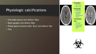 Physiologic calcifications
• Choroidal plexus-rare before 10yrs
• Basal ganglia-rare before 40ys
• Pineal gland-common after 30 yr rare before 10yr
• Falx
 