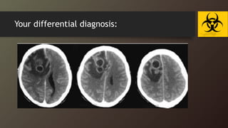 Your differential diagnosis:
 