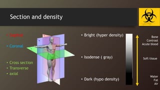 Section and density
• Sagittal
• Coronal
• Cross section
• Transverse
• axial
• Bright (hyper density)
• Isodense ( gray)
• Dark (hypo density)
Bone
Contrast
Acute blood
Soft tissue
Water
Fat
Air
 
