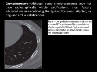 CT scan of Rib pathologies | PPTX