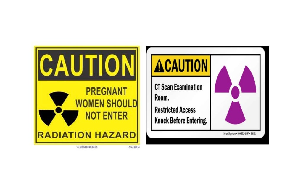 Radiation hazards in CT scan