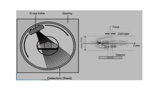 COMPUTED TOMOGRAPHY (CT)simple way to learn | PPTX