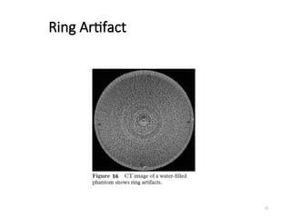Basic Computed Tomography for Medical Imaging | PPT