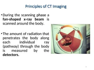 Basic Computed Tomography for Medical Imaging | PPT