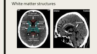 White matter structures
 