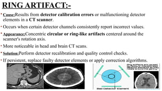 RING ARTIFACT:-
 Cause:Results from detector calibration errors or malfunctioning detector
elements in a CT scanner.
• Occurs when certain detector channels consistently report incorrect values.
 Appearance:Concentric circular or ring-like artifacts centered around the
scanner's rotation axis.
• More noticeable in head and brain CT scans.
 Solution:Perform detector recalibration and quality control checks.
• If persistent, replace faulty detector elements or apply correction algorithms.
 