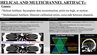HELICALAND MULTICHANNELARTIFACT:-
Causes:
Helical Artifacts: Incomplete data reconstruction, pitch too high, or motion.
Multichannel Artifacts: Detector calibration errors, cross-talk between channels.
windmill artifact cone beam effect
Cause:Occurs in multi-detector CT (MDCT) when using a high pitch value in helical
scanning.
Caused by the overlap and rotation of detector rows, leading to aliasing effects.
Appearance:Repeating fan-shaped or windmill-like streaks across the image.
Most noticeable in high-contrast areas, causing distortion.
Solution:Reduce pitch value to minimize excessive interpolation errors.
Use advanced reconstruction algorithms to correct the artifact.
Cause:Occurs in multi-detector CT (MDCT) and cone-beam CT (CBCT) due to the wide
cone-shaped X-ray beam.
More prominent in scanners with more detector rows, where standard reconstruction
algorithms struggle with peripheral data.
Appearance:Streaks, shading, or distortion at the edges of the image.
Can cause blurring and inaccurate structure representation, especially in 3D reconstructions.
Solution:Use cone-beam reconstruction algorithms like Feldkamp-Davis-Kress (FDK).
Reduce cone angle or use central slices for more accurate imaging.
Windmill artefact
Windmill artefact Normal image
 