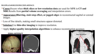 MULTIPLANAR RECONSTRUCTION ARTIFACT:
 Cause:Occurs when thick slices or low-resolution data are used for MPR in CT and
MRI.Results from partial volume averaging and interpolation errors.
 Appearance:Blurring, stair-step effect, or jagged edges in reconstructed sagittal or coronal
images.
• Loss of fine details, making small structures appear distorted.
 Solution:Use thin-slice imaging to improve resolution.
• Apply higher-quality interpolation algorithms to enhance reconstruction accuracy.
ZEBRA ARTEFACT
 